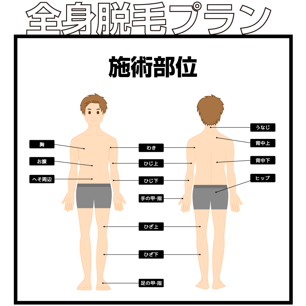全身脱毛プラン施術部位