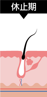 休止期